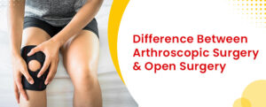 Difference Between Arthroscopic Surgery And Open Surgery Germanten