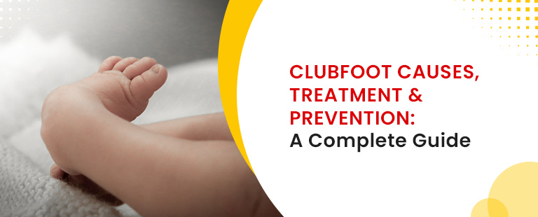 Clubfoot Causes, Treatment & Prevention- A Complete Guide