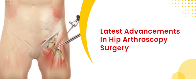 Latest-Advancements-In-Hip-Arthroscopy-Surgery