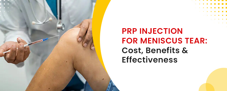PRP Injection for Meniscus Tear- Cost, Benefits & Effectiveness