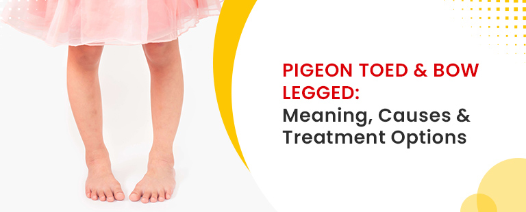 Pigeon Toed & Bow Legged- Meaning, Causes & Treatment Options