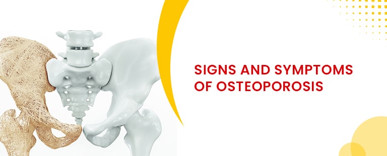 Signs and Symptoms Of Osteoporosis (Bone Weakness)