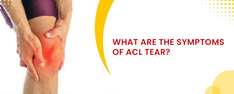 What are the symptoms of acl tear
