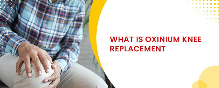 What Is Oxinium Knee Replacement