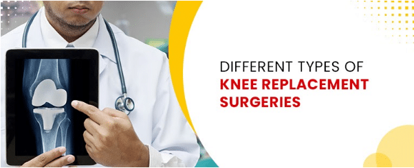 Different Types of knee replacement surgeries